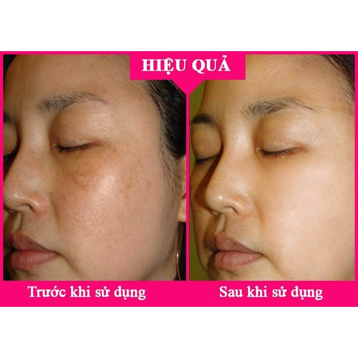 Kem dưỡng trắng da mờ nám KPEM của Nga 100ml