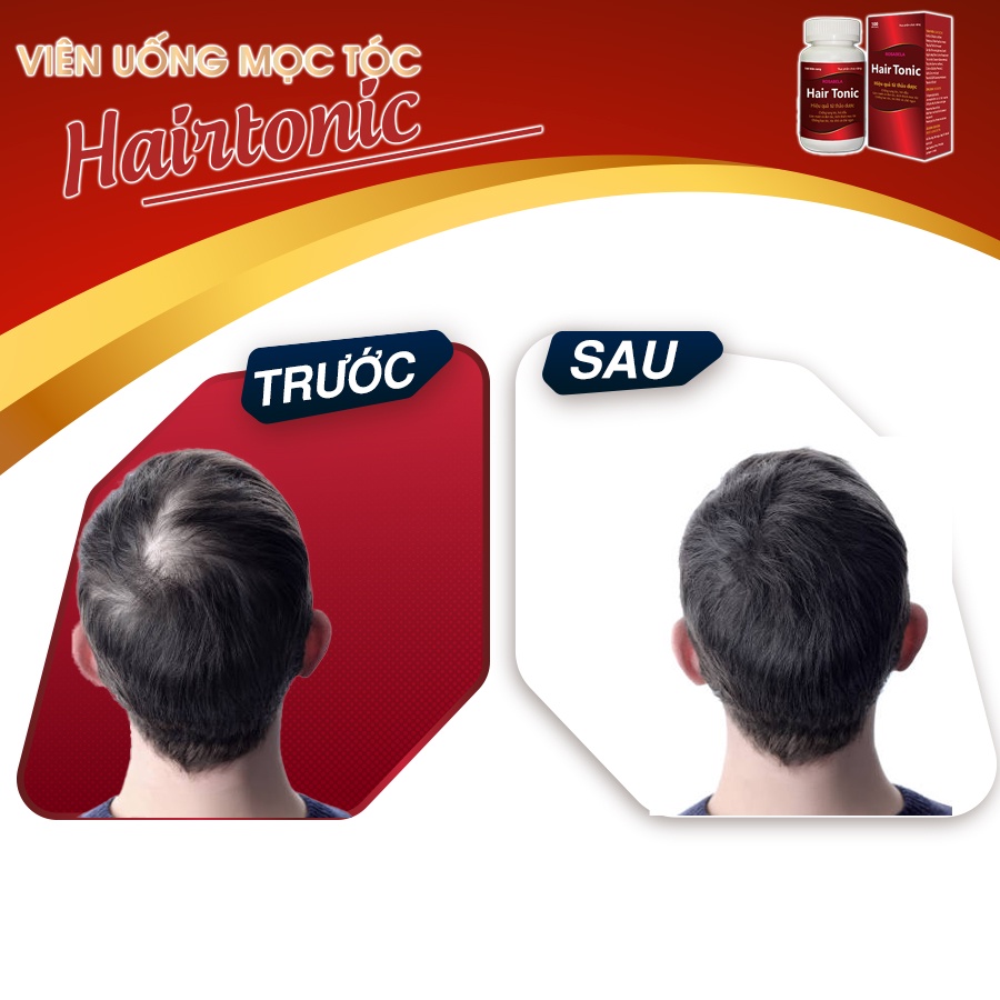 Viên uống mọc tóc Hairtonic, giảm rụng tóc, kích thích tóc mọc nhanh, chắc khỏe, suôn mượt (100 viên)