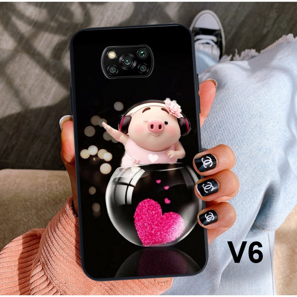 ỐP LƯNG ĐIỆN THOẠI XIAOMI POCO X3/POCOX3NFC/POCO X3PRO ỐP LƯNG IN HÌNH SIÊU CUTE VÀ DỄ THƯƠNG GLSHOP
