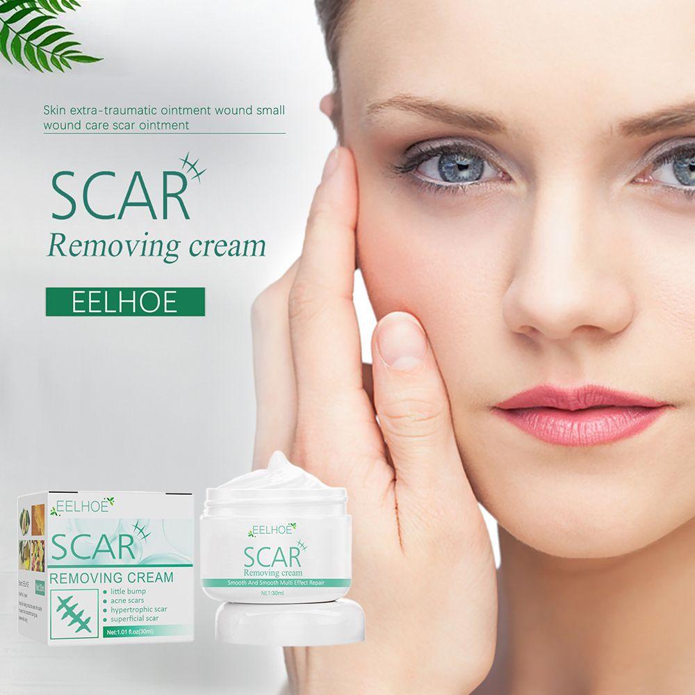 Kem Hỗ trợ giảm sẹo XIANTIN Chất Lượng Cao Tiện Dụng