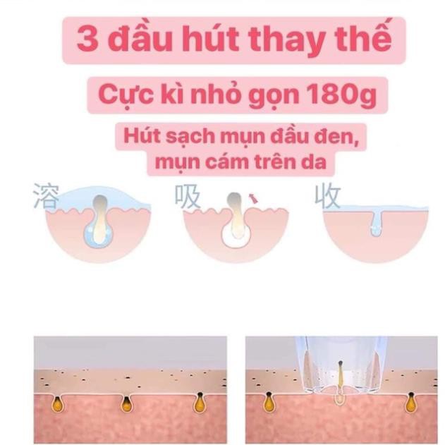 <GIÁ SỐC> MÁY HÚT MỤN CẦM TAY