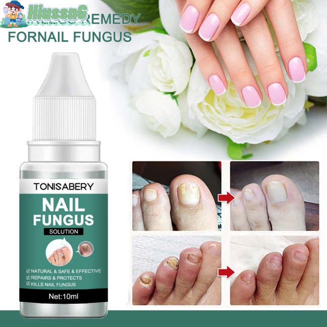Serum Dưỡng Móng 10ml Giúp Nuôi Dưỡng Và Giữ Ẩm Hiệu Quả