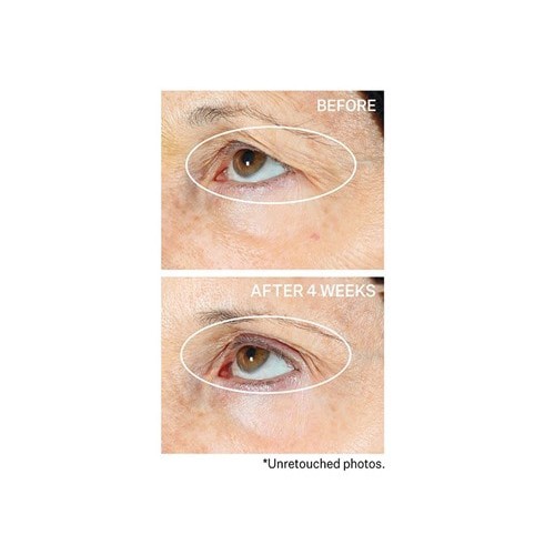 Tinh chất dưỡng giúp săn chắc và sáng da Strivectin Peptight™ Tightening & Brightening Face