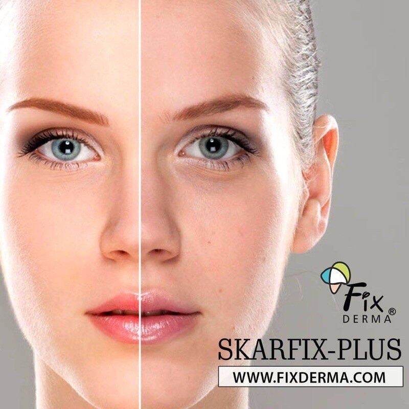 Kem Dưỡng Trắng Da Giảm Nám Tàn Nhang Mờ Thâm Mụn Skarfix TX Fixderma Nhập Khẩu Chính Hãng