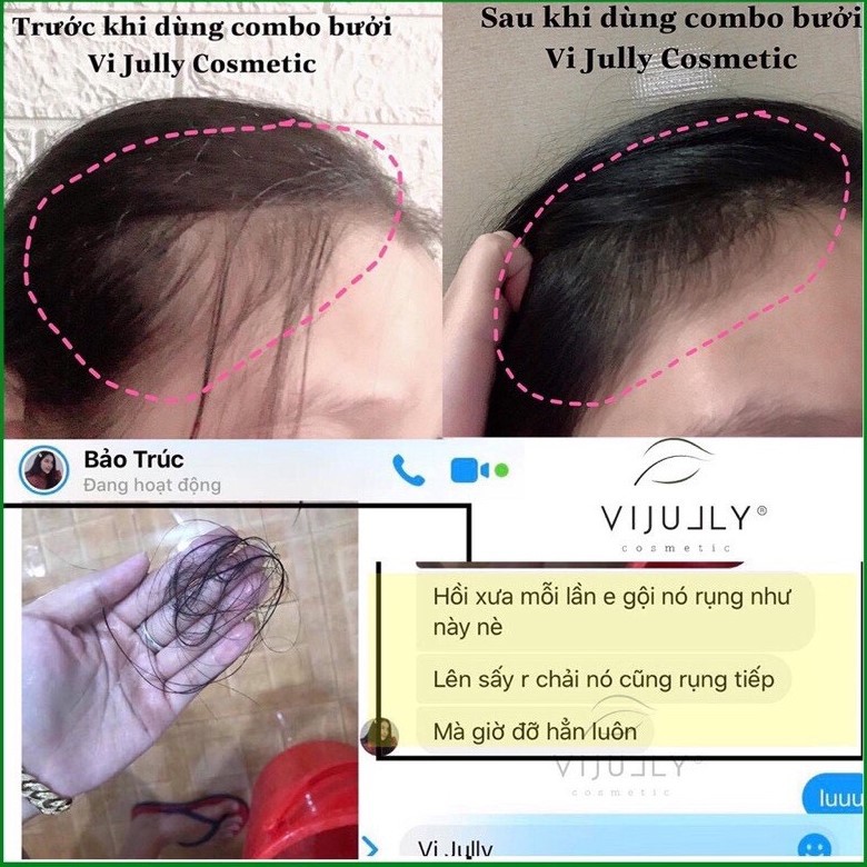Tinh Dầu Xịt Bưởi Vijully Kích Mọc Tóc Nhanh, Ngăn Rụng Tóc