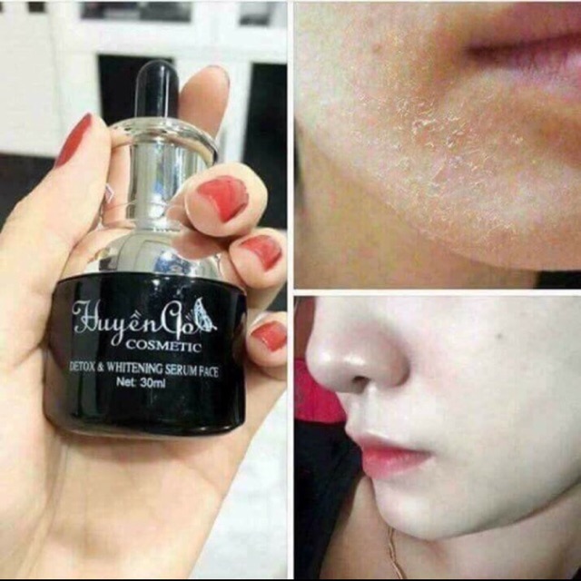 Combo Serum+face huyền cò
