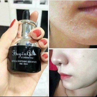 Combo Serum+face huyền cò