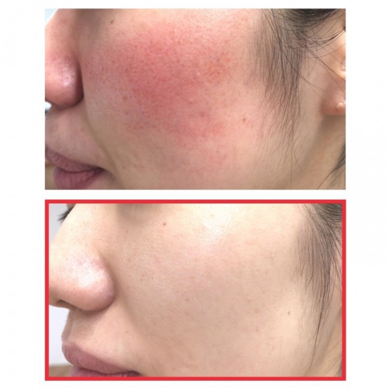 [Chính hãng] Kem Dưỡng Ẩm Phục Hồi, Cải Thiện Sẹo Lõm Chiết Xuất Ốc Sên Some By Mi Snail Truecica | BigBuy360 - bigbuy360.vn