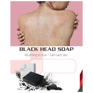Xà phòng rửa mặt giảm mụn lưng than hoạt tính goodndoc blackhead soap 100g