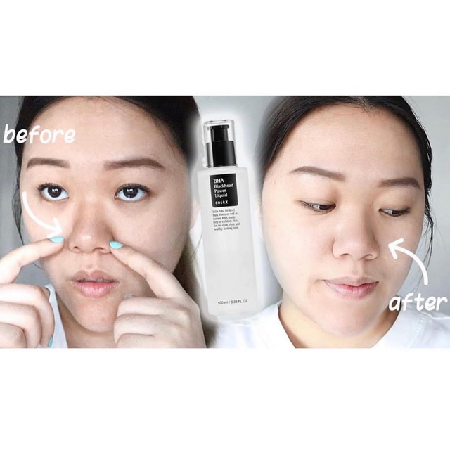 TINH CHẤT COSRX BHA BLACKHEAD POWDER LIQUID