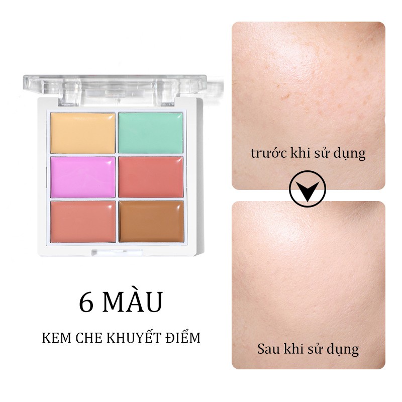 Kem Che Khuyết Điểm Lameila Che Phủ Quầng Thâm Mắt