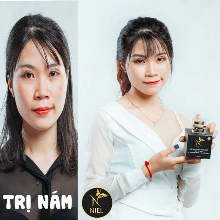 Kem giảm nám Niel Melasma Thái Lan - PN014