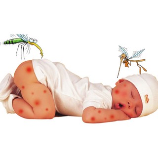 KEM BÔI TRỊ MUỖI VÀ CÔN TRÙNG ĐỐT MUHI S 15GR