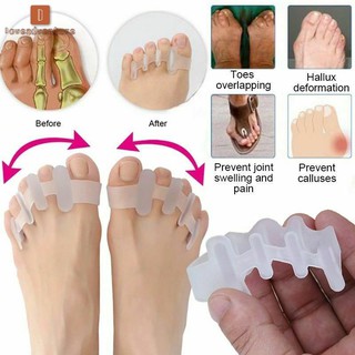 2 Cặp dụng cụ tách ngón chân chỉnh sửa ngón chân chồng lên nhau/biến dạng ngón cái chăm sóc bàn chân