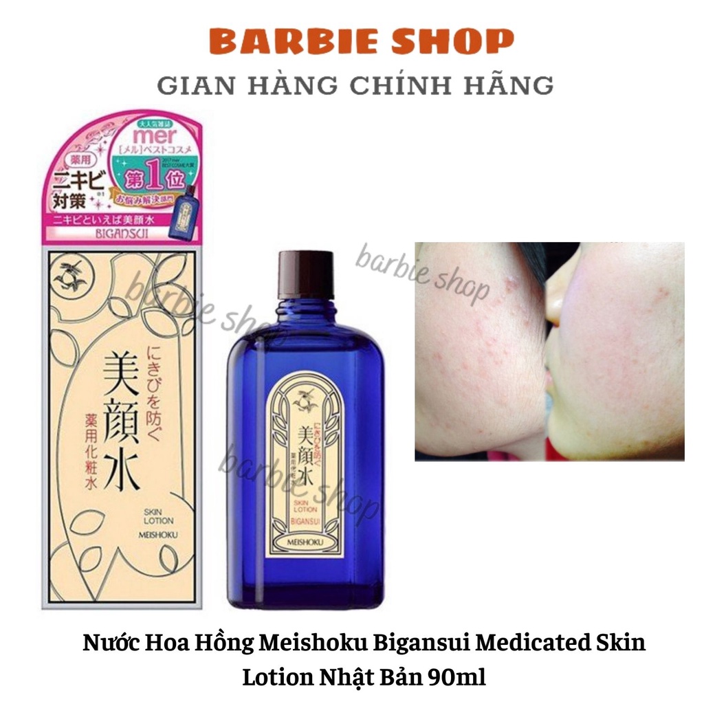 Nước Hoa Hồng Meishoku Bigansui Medicated Skin Lotion Nhật Bản 90ml