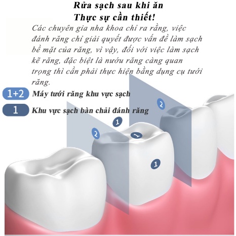 máy tăm nước（3 chế độ dội nước）cầm tay Oral Irrigator-XQY-64