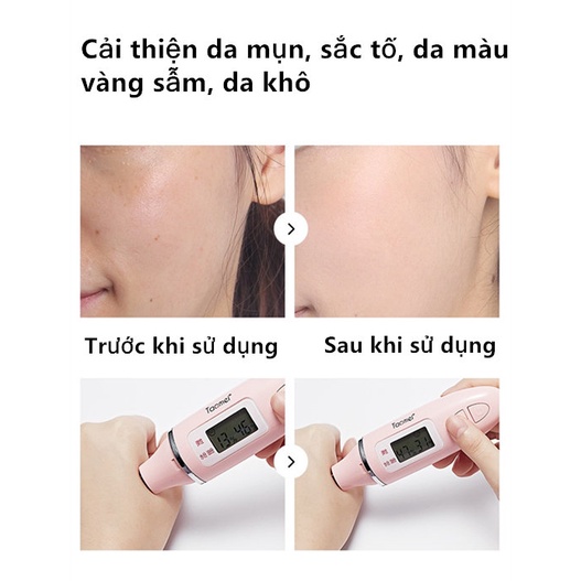 Venzen Gel Hỗ trợ giảm mụn Và Tàn Nhang Dưỡng Ẩm Làm Sáng Da Dịu Nhẹ