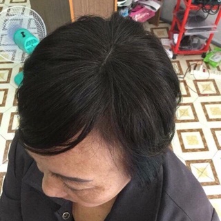 Tóc giả mái dài che hói