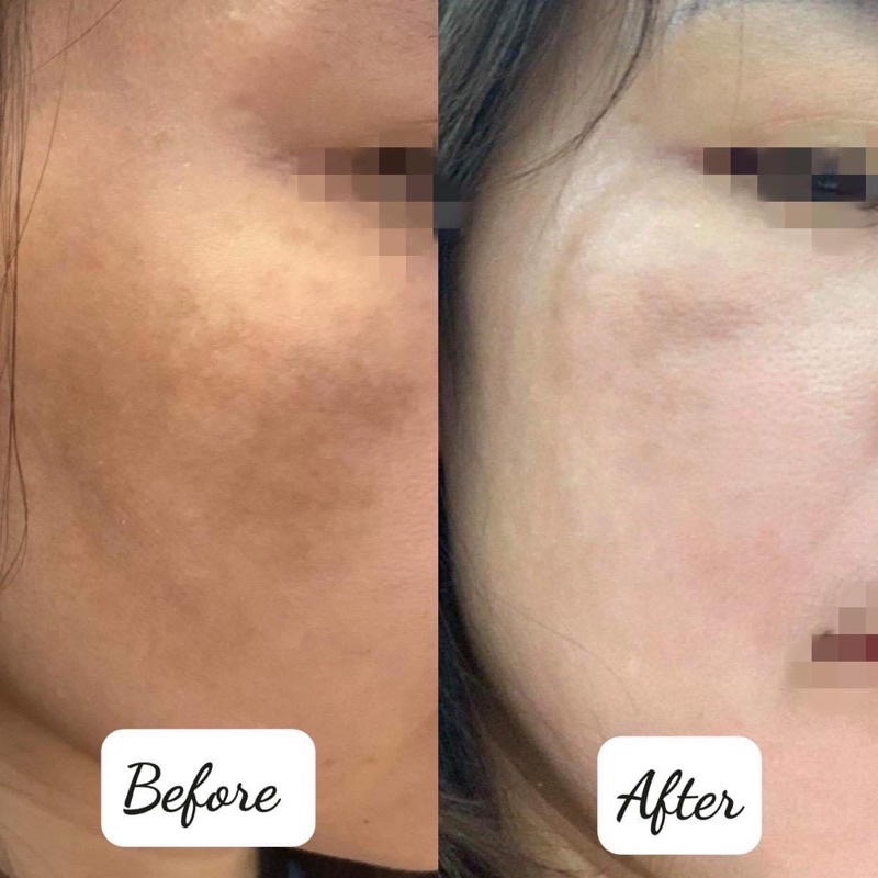 Kem Dưỡng Da Scinic Cicanoid Retinal 30mL .