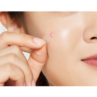 Miếng dán mụn Mayancare xẹp mụn gom cồi mụn cấp tốc