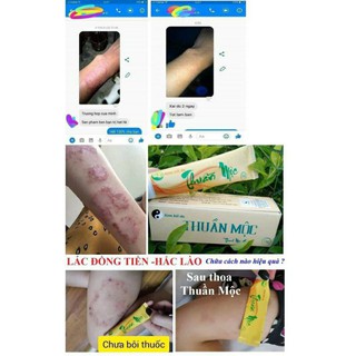 Kem bôi da Thuần khắc tinh của da Mộc