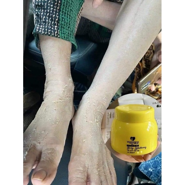 Kem Body Bong Da Phương Anh