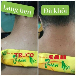 Kem bôi da