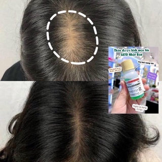 Tinh Chất serum mọc tóc JG Nhật Bản