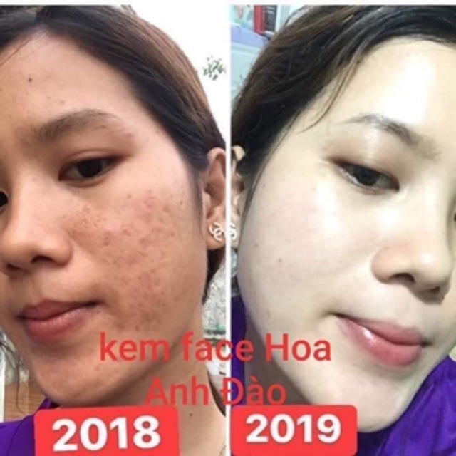 [CHÍNH HÃNG] チェリー KEM FACE HOA ANH ĐÀO NHẬT BẢN