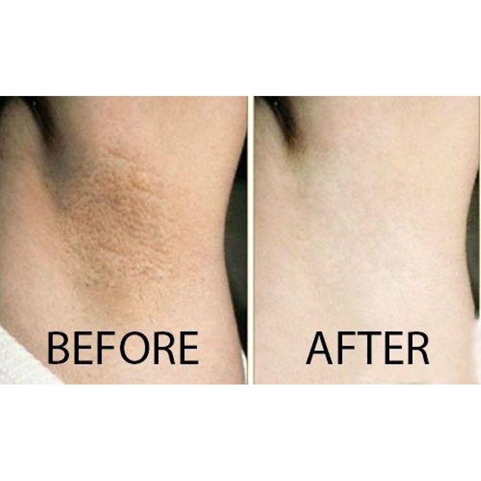 Kem Trị Thâm Nách Vacosi Whitening Armpit Cream 30ml giảm chỉ còn 95,000 đ