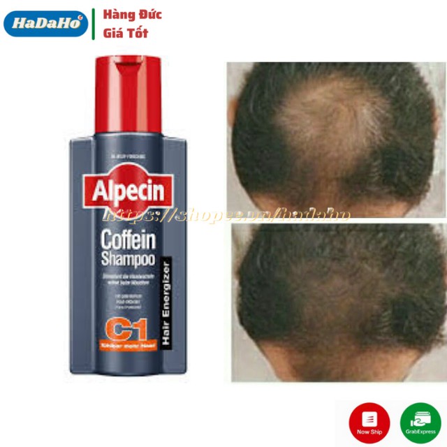 Dầu gội ALPECIN COFFEIN SHAMPOO C1 ĐỨC