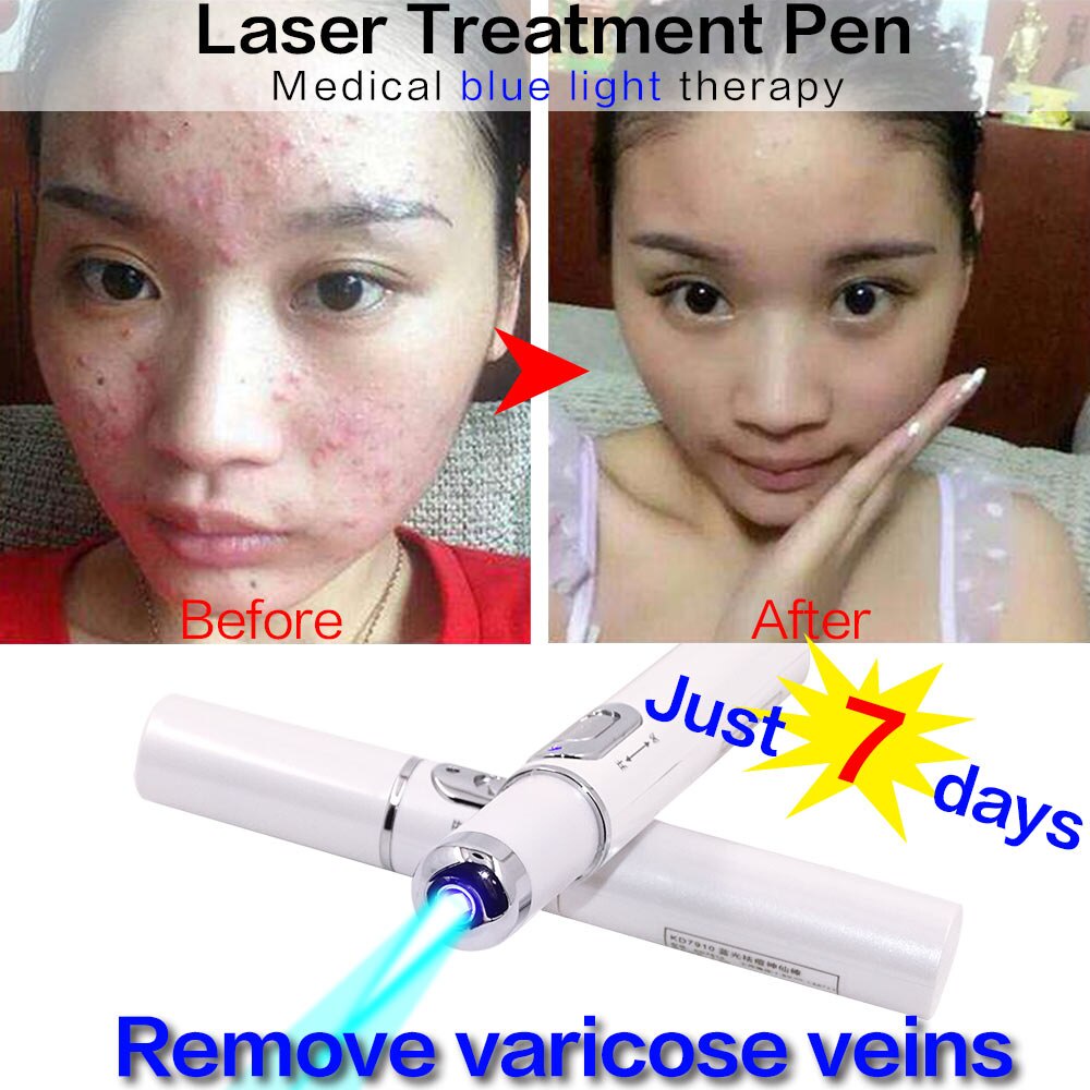 Bộ Máy Hỗ trợ giảm mụn + Bút Laser + Sẹo Mềm + Vết Trầy + Làm Dịu Nếp Nhăn + Thiết Bị Chăm Sóc Da DG-002