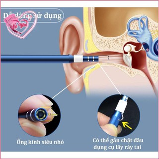 Camera nội soi ráy tai đa năng