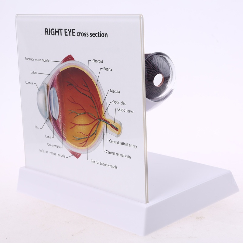 Wer Mô Hình Bóng Mắt Phải Người Cho Trưng Bày Glaucoma Cross Section Anatomical Glaucoma Teac