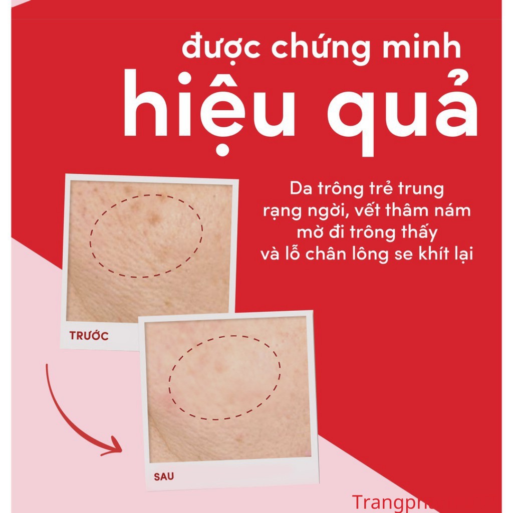 Pond's ngăn ngừa lão hóa kem dưỡng ban ngày / đêm 50g