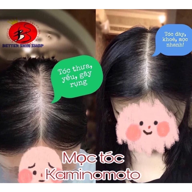 Thoa mọc tóc Kaminomoto