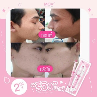 Siêu tinh chất MOA collagen