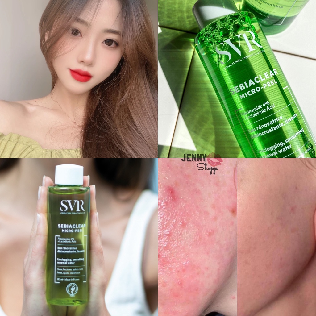 Nước Hoa Hồng SVR Sebiaclear Micro-Peel