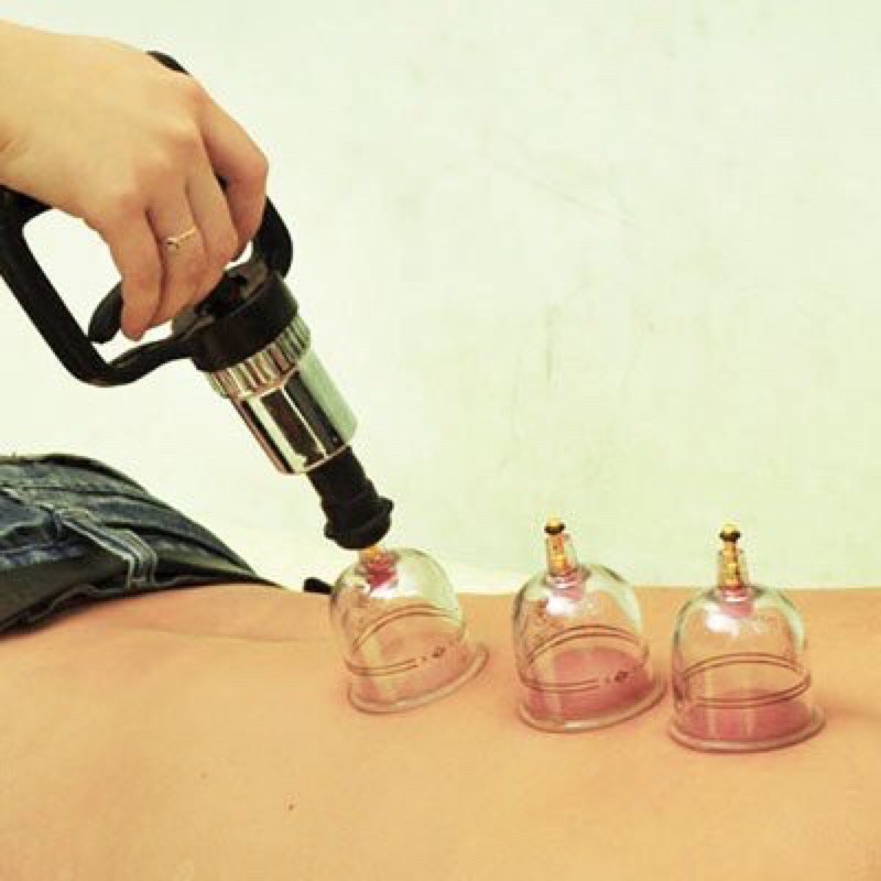 Bộ giác hơi huy thành nguyên hộp