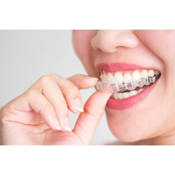 Khay duy trì trong suốt chỉnh nha, máng cứng trong suốt Truesmile