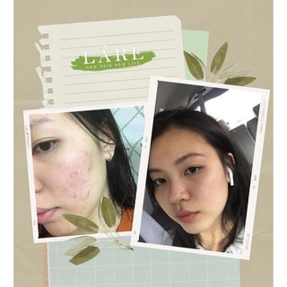 30ml serum Thanh Dược Lare