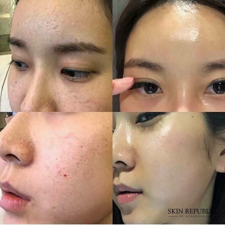 Red Peel - Serum Tái Tạo Phục Hồi Da Sinh Học