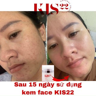 Kem Face Kiss_22