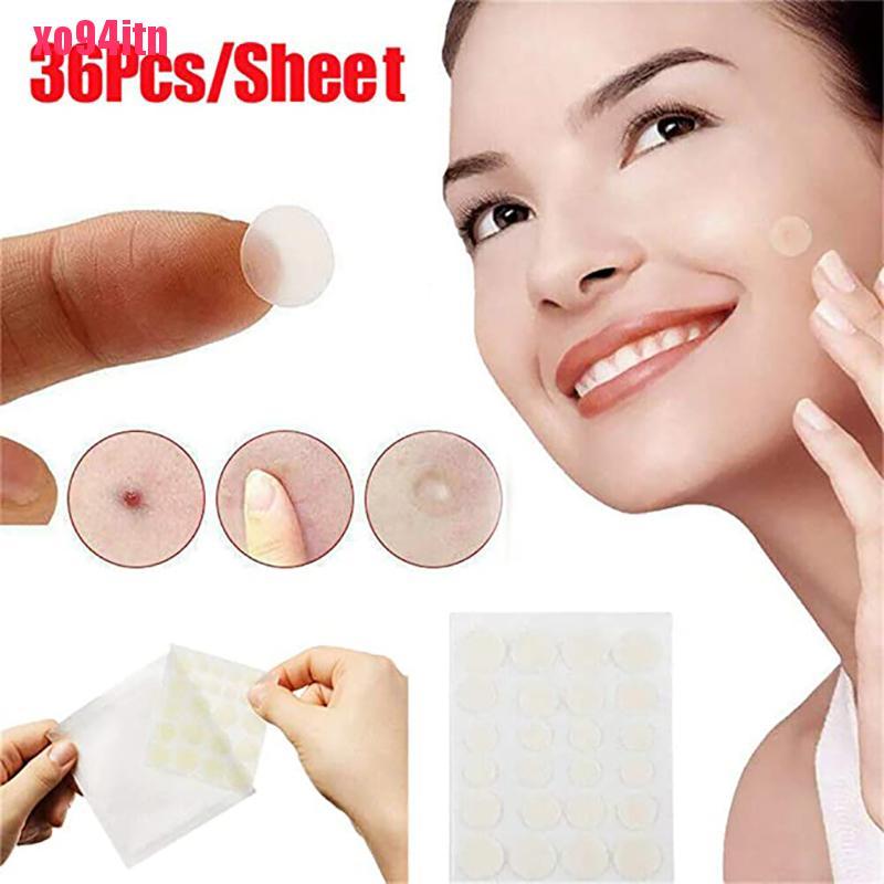 [Hàng mới về] Set 36 miếng dán hỗ trợ giảm mụn hydrocolloid hiệu quả