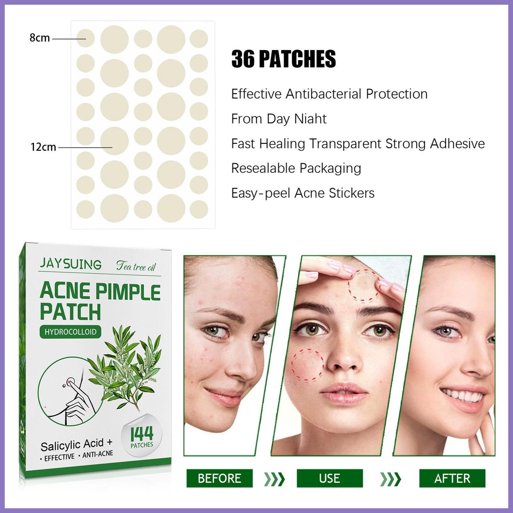 Miếng Dán Trị Mụn Vô Hình 144 Miếng nota2vn