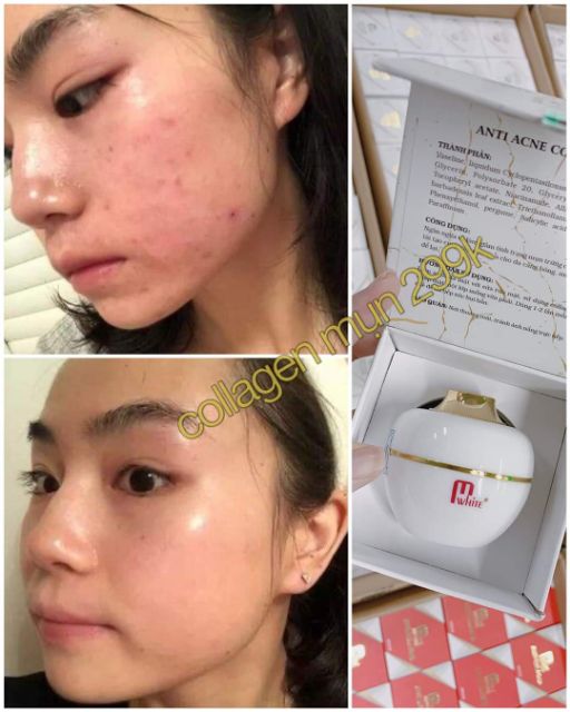 TRUYỀN TRẮNG COLLAGEN FACE MWHITE | BigBuy360 - bigbuy360.vn