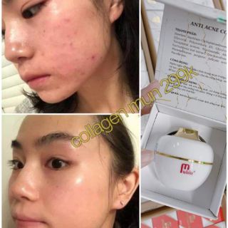 TRUYỀN TRẮNG COLLAGEN FACE MWHITE