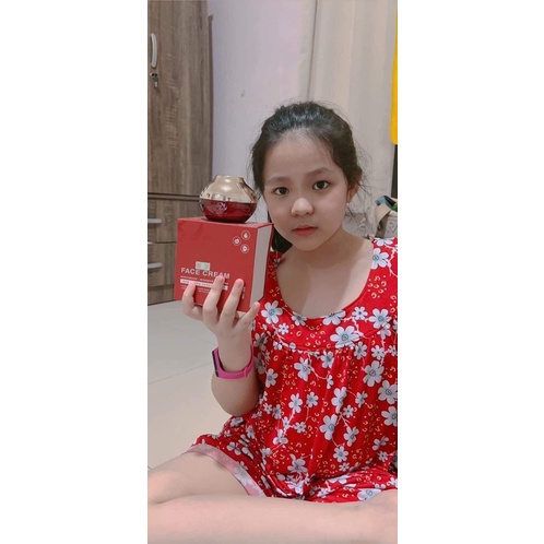 Kem Face Tys Đỏ 4in1 Trắng Da Mờ Nám Lớn 35gram