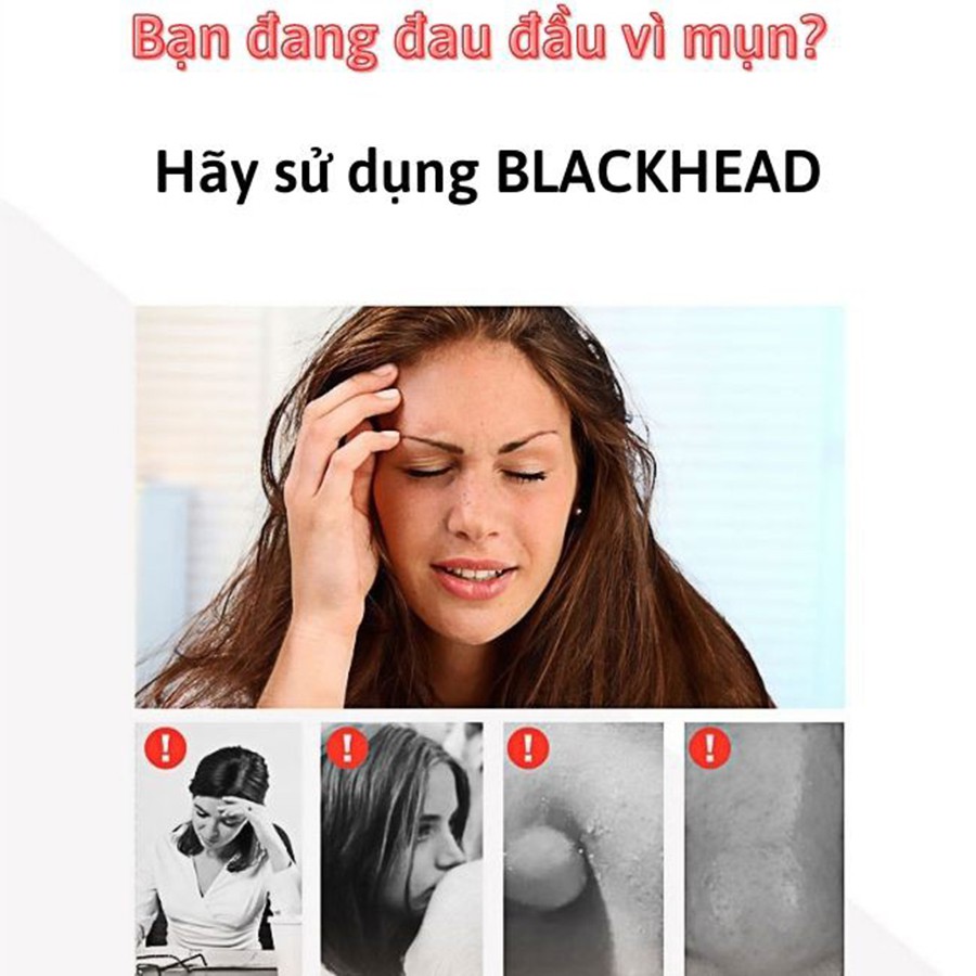 Máy hút mụn|Máy hút mụn đầu đen,mụn cám siêu sạch,siêu mạnh  Blackhead instrument