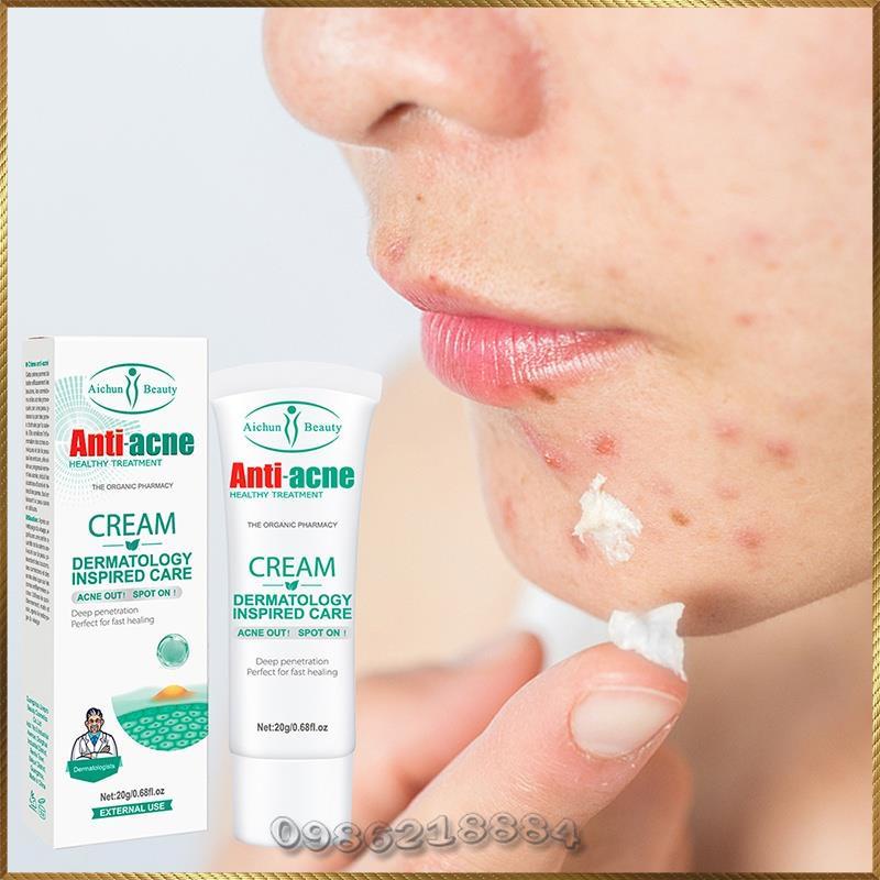 Kem mụn Aichun Anti-ACNE Cream xoá mụn giảm mụn ngừa mụn A4689